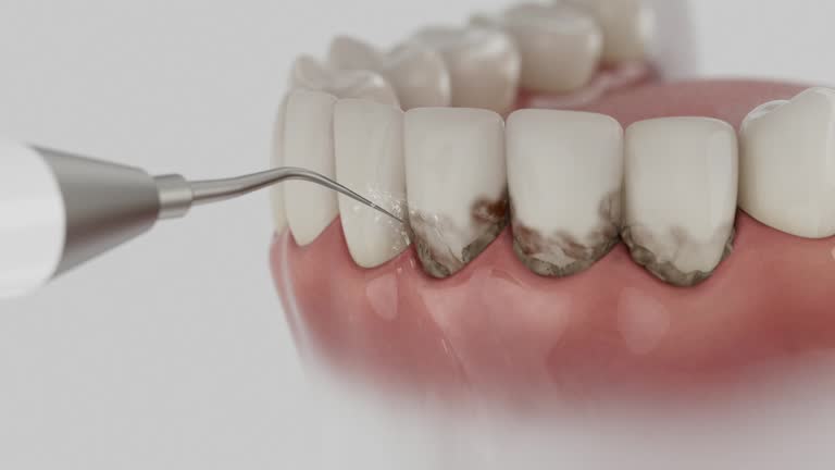 Reliable Teeth Cleaning And Checkup contractor in Osborne County County, KS by Dentist Open Now